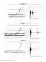 Fig. 05 - Method for non-invasively detecting the narrowing of a lumen