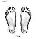 Fig. 03 - PRESSURE PLATE DEVICE FOR ORTHOTIC SELECTION