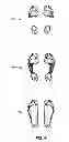 Fig. 05 - PRESSURE PLATE DEVICE FOR ORTHOTIC SELECTION