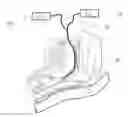Fig. 01 - Airway oxygenator