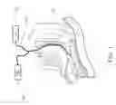 Fig. 02 - Airway oxygenator