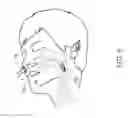 Fig. 07 - Airway oxygenator