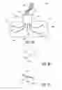 Fig. 03 - Implantable multi-electrode device