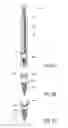 Fig. 05 - Implantable multi-electrode device