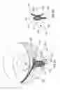 Fig. 06 - Device for sampling tear fluid