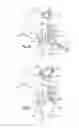 Fig. 11 - APPARATUS AND METHOD FOR MEASURING FORCES IN A KNEE JOINT