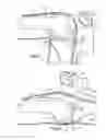 Fig. 14 - APPARATUS AND METHOD FOR MEASURING FORCES IN A KNEE JOINT