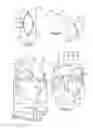 Fig. 17 - APPARATUS AND METHOD FOR MEASURING FORCES IN A KNEE JOINT