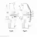 Fig. 25 - APPARATUS AND METHOD FOR MEASURING FORCES IN A KNEE JOINT