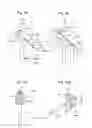 Fig. 27 - APPARATUS AND METHOD FOR MEASURING FORCES IN A KNEE JOINT
