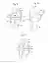Fig. 30 - APPARATUS AND METHOD FOR MEASURING FORCES IN A KNEE JOINT