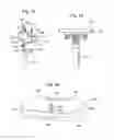 Fig. 31 - APPARATUS AND METHOD FOR MEASURING FORCES IN A KNEE JOINT
