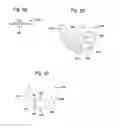 Fig. 33 - APPARATUS AND METHOD FOR MEASURING FORCES IN A KNEE JOINT