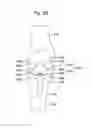 Fig. 34 - APPARATUS AND METHOD FOR MEASURING FORCES IN A KNEE JOINT