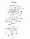 Fig. 35 - APPARATUS AND METHOD FOR MEASURING FORCES IN A KNEE JOINT
