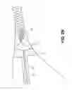 Fig. 04 - METHODS AND APPARATUS FOR DETERMINING FALLOPIAN TUBE OCCLUSION