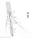 Fig. 06 - METHODS AND APPARATUS FOR DETERMINING FALLOPIAN TUBE OCCLUSION
