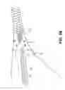 Fig. 07 - METHODS AND APPARATUS FOR DETERMINING FALLOPIAN TUBE OCCLUSION