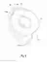 Fig. 13 - Attachment for Epilator and Epilator