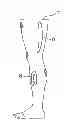 Fig. 01 - Compression element