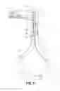 Fig. 04 - Detachable orthopedic sling