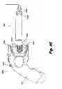 Fig. 40 - System and method for improved gas recirculation in surgical trocars with pneumatic sealing