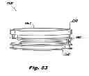 Fig. 48 - System and method for improved gas recirculation in surgical trocars with pneumatic sealing