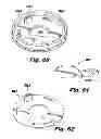 Fig. 52 - System and method for improved gas recirculation in surgical trocars with pneumatic sealing