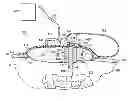 Fig. 01 - Reduced-pressure systems, devices, and methods for treating a tissue site that includes a fistula