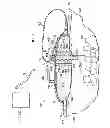 Fig. 02 - Reduced-pressure systems, devices, and methods for treating a tissue site that includes a fistula