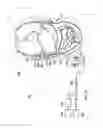 Fig. 07 - Sleeves, manifolds, systems, and methods for applying reduced pressure to a subcutaneous tissue site