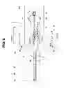 Fig. 06 - Insertion apparatus