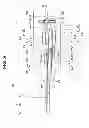 Fig. 09 - Insertion apparatus
