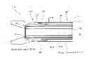 Fig. 01 - Fluid recirculation debris handling system