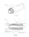 Fig. 02 - Fluid recirculation debris handling system