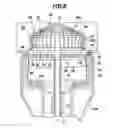 Fig. 09 - Anastomosis device with collapsible distal head element