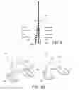 Fig. 06 - Methods and apparatus for performing knee arthroplasty