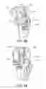 Fig. 35 - Methods and apparatus for performing knee arthroplasty
