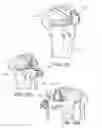 Fig. 40 - Methods and apparatus for performing knee arthroplasty