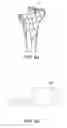 Fig. 43 - Methods and apparatus for performing knee arthroplasty