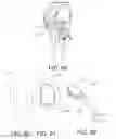 Fig. 45 - Methods and apparatus for performing knee arthroplasty