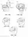 Fig. 63 - Methods and apparatus for performing knee arthroplasty