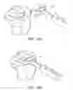 Fig. 65 - Methods and apparatus for performing knee arthroplasty