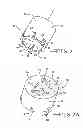 Fig. 09 - Instrument for reshaping the head of a femur