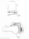 Fig. 04 - Device for positioning a bone cutting guide