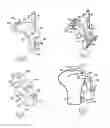 Fig. 05 - Device for positioning a bone cutting guide