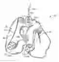 Fig. 01 - Patient-specific-bone-cutting guidance instruments and methods