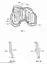 Fig. 02 - Patient-specific-bone-cutting guidance instruments and methods