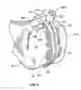 Fig. 07 - Patient-specific-bone-cutting guidance instruments and methods
