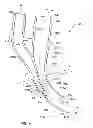 Fig. 04 - Arterial device, system and method for removing embolic debris